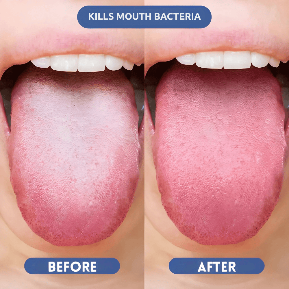 The Breath Co.™ Probiotic Breath Spray